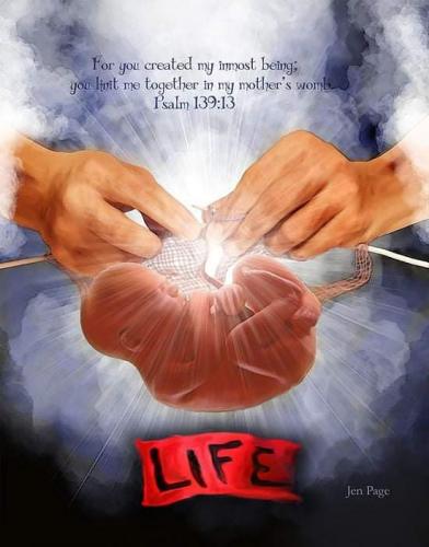 9-27-20 "Abortion Dream"