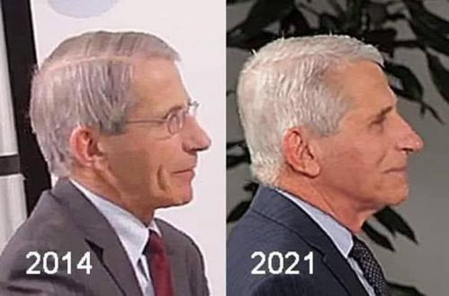 Fauci or Fauci
